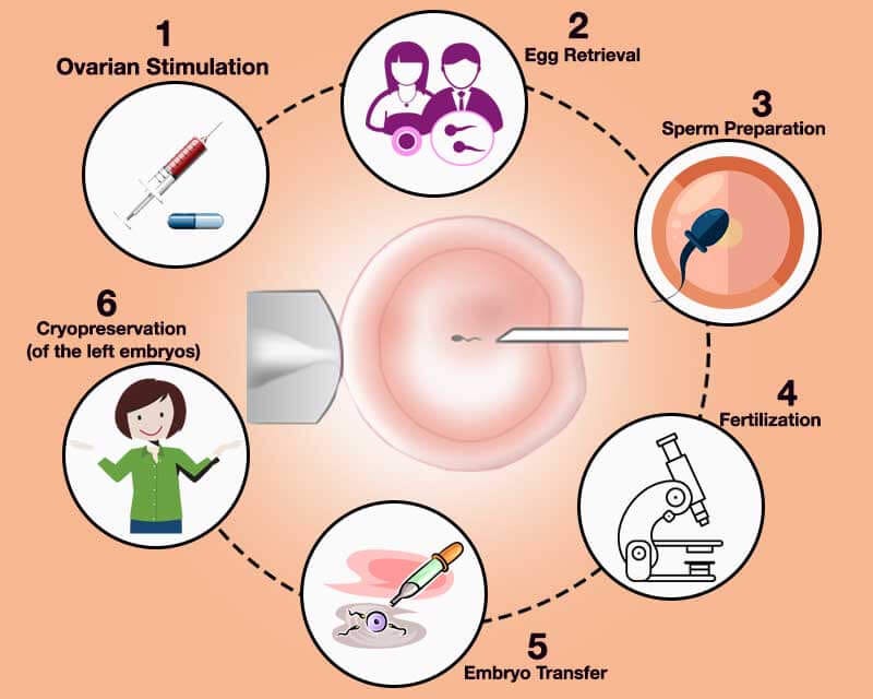 ICSI Treatment in Junagadh: Modern Solutions
