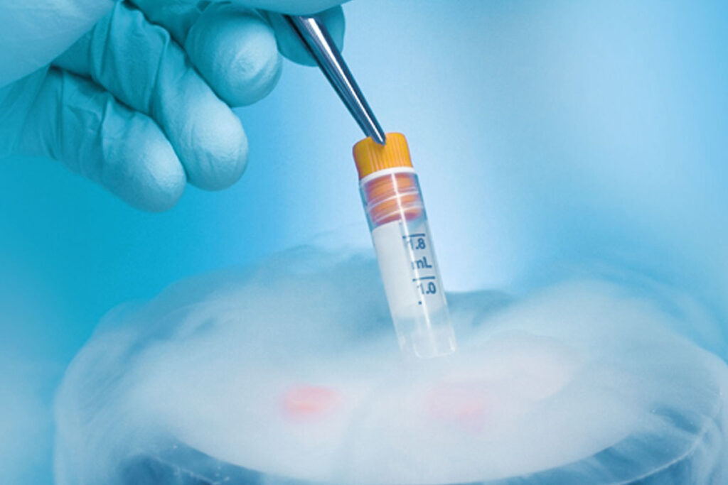 Fertility Centre in Junagadh best ivf center in junagadh ICSI treatment in Junagadh