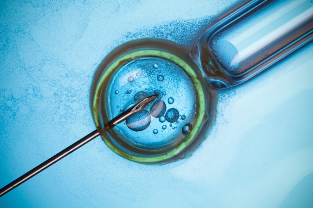 Fertility Centre in Junagadh best ivf center in junagadh ICSI treatment in Junagadh