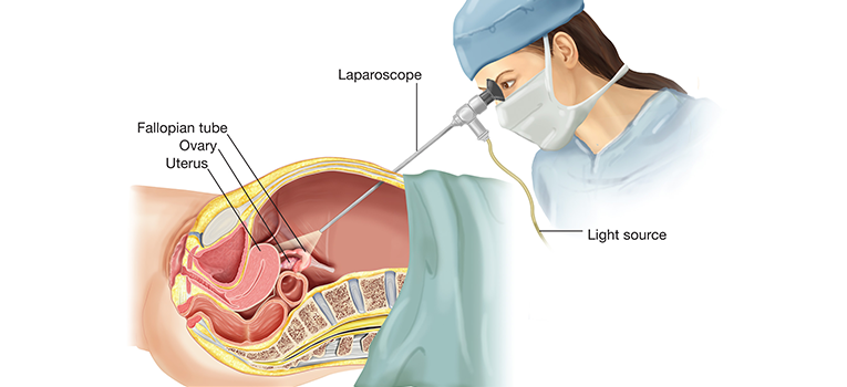 Fertility Centre in Junagadh best ivf center in junagadh ICSI treatment in Junagadh