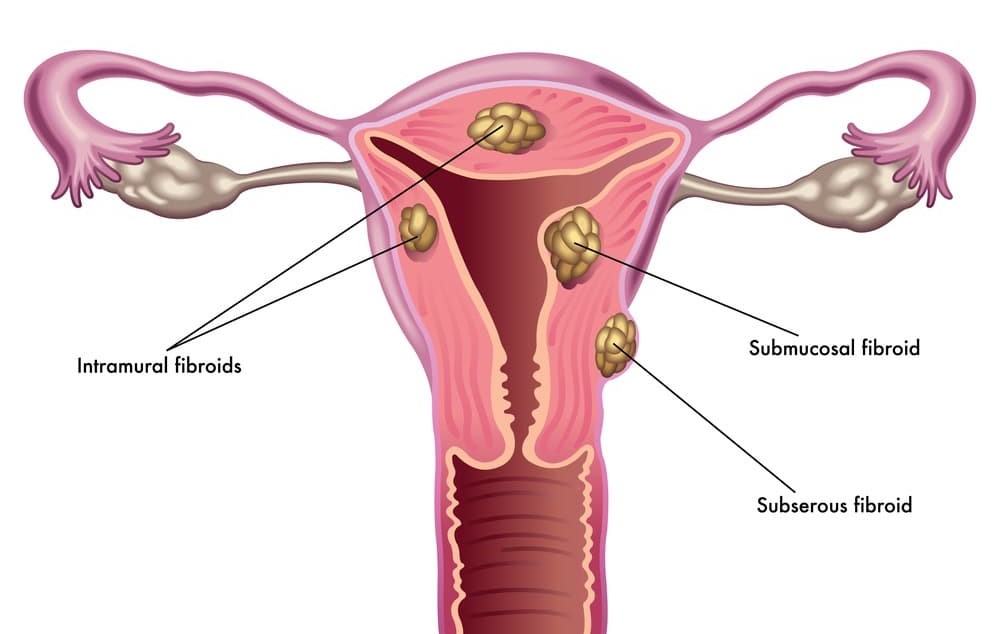 Fertility Centre in Junagadh best ivf center in junagadh ICSI treatment in Junagadh