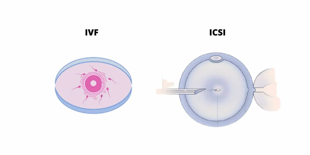 Fertility Centre in Junagadh best ivf center in junagadh ICSI treatment in Junagadh