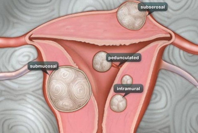 Fertility Centre in Junagadh best ivf center in junagadh ICSI treatment in Junagadh