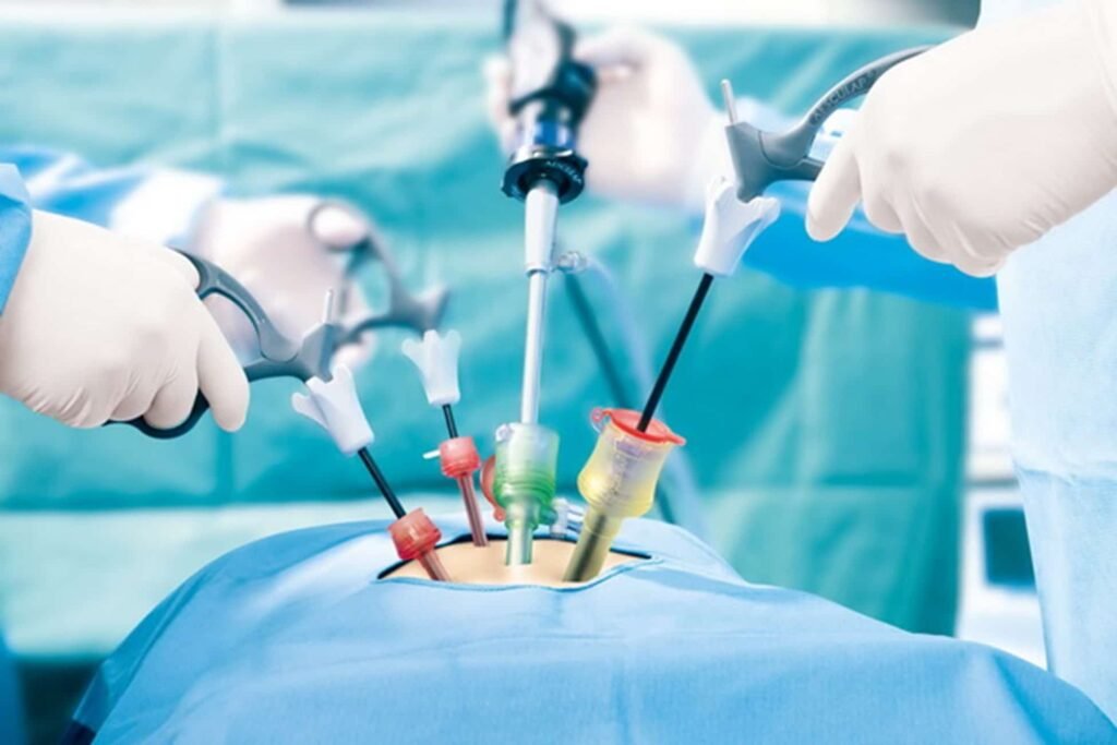 laparoscopy surgery, laparoscopy treatment, minimally invasive surgery, laparoscopy benefits, laparoscopic surgery in Junagadh, best IVF center in Junagadh, fertility center in Junagadh, ICSI treatment in Junagadh, infertility treatment, endometriosis treatment, ovarian cyst removal, tubal ligation reversal, fertility treatment in Junagadh, gynecological laparoscopy, laparoscopic fertility treatment, laparoscopic gynecological surgery, best laparoscopy surgeon in Junagadh, laparoscopic procedure recovery