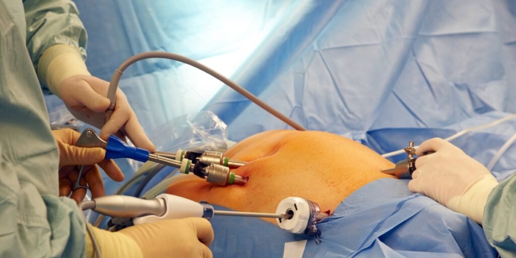 laparoscopy surgery, laparoscopy treatment, minimally invasive surgery, laparoscopy benefits, laparoscopic surgery in Junagadh, best IVF center in Junagadh, fertility center in Junagadh, ICSI treatment in Junagadh, infertility treatment, endometriosis treatment, ovarian cyst removal, tubal ligation reversal, fertility treatment in Junagadh, gynecological laparoscopy, laparoscopic fertility treatment, laparoscopic gynecological surgery, best laparoscopy surgeon in Junagadh, laparoscopic procedure recovery