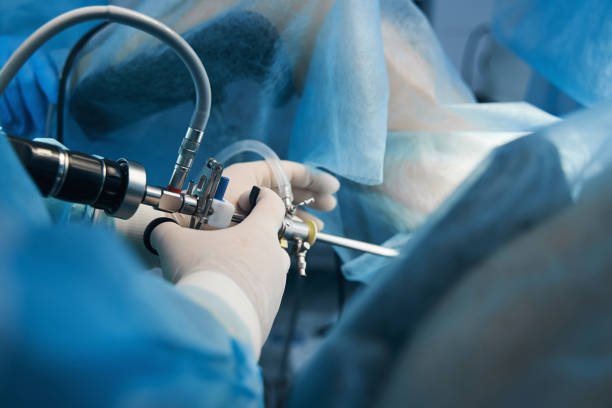 laparoscopy surgery, laparoscopy treatment, minimally invasive surgery, laparoscopy benefits, laparoscopic surgery in Junagadh, best IVF center in Junagadh, fertility center in Junagadh, ICSI treatment in Junagadh, infertility treatment, endometriosis treatment, ovarian cyst removal, tubal ligation reversal, fertility treatment in Junagadh, gynecological laparoscopy, laparoscopic fertility treatment, laparoscopic gynecological surgery, best laparoscopy surgeon in Junagadh, laparoscopic procedure recovery