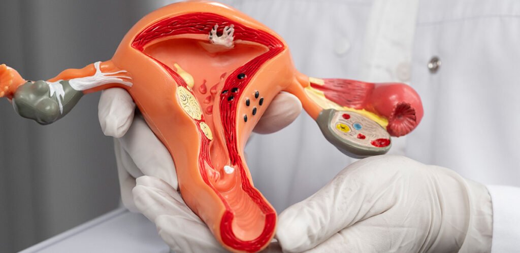 Hysteroscopy, infertility diagnosis, best IVF center in Junagadh, IVF success, fertility treatment, ICSI treatment in Junagadh, uterine health, fertility specialist, uterine polyps, fibroids treatment, Asherman’s Syndrome, repeated IVF failures, unexplained infertility, abnormal bleeding, miscarriage treatment, hysteroscopy benefits, minimally invasive fertility procedure, embryo implantation, uterine abnormalities, fertility center in Junagadh