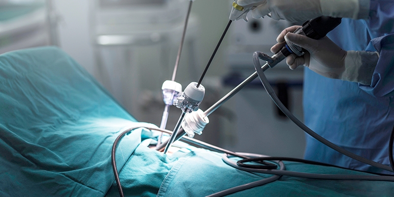 laparoscopic surgery, gynecological surgery, minimally invasive surgery, laparoscopic treatment, fertility treatment, IVF hospital, laparoscopic gynecology, uterine fibroids treatment, endometriosis surgery, ovarian cyst removal, ectopic pregnancy treatment, pelvic inflammatory disease, keyhole surgery, advanced laparoscopic techniques, best gynecologist, laparoscopic surgeon, fertility care, women’s health care, reproductive health, gynecological procedures, Unique Hospital, best IVF hospital