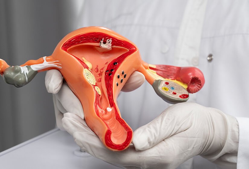 best IVF center in Junagadh, endometriosis treatment in Junagadh, Unique IVF Centre Junagadh, endometriosis and infertility, IVF for endometriosis, Dr. Pravin Dudhat IVF specialist, fertility treatment in Junagadh, IVF success with endometriosis, laparoscopic surgery for endometriosis, ICSI treatment in Junagadh, ovulation induction for endometriosis, endometrial cyst treatment Junagadh, pelvic pain and infertility, hormonal therapy for endometriosis, endometriosis diagnosis Junagadh, infertility solutions Junagadh, best fertility clinic Junagadh, IVF and IUI Junagadh, expert gynecologist Junagadh, reproductive health center Junagadh