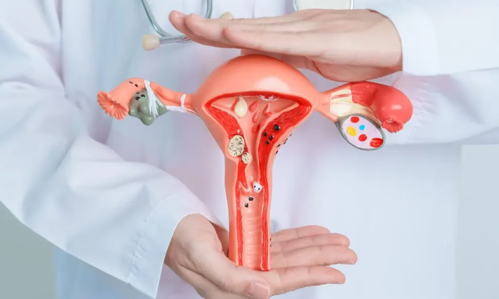 best IVF center in Junagadh, endometriosis treatment in Junagadh, Unique IVF Centre Junagadh, endometriosis and infertility, IVF for endometriosis, Dr. Pravin Dudhat IVF specialist, fertility treatment in Junagadh, IVF success with endometriosis, laparoscopic surgery for endometriosis, ICSI treatment in Junagadh, ovulation induction for endometriosis, endometrial cyst treatment Junagadh, pelvic pain and infertility, hormonal therapy for endometriosis, endometriosis diagnosis Junagadh, infertility solutions Junagadh, best fertility clinic Junagadh, IVF and IUI Junagadh, expert gynecologist Junagadh, reproductive health center Junagadh