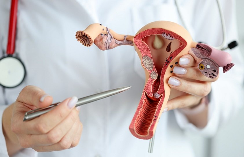 best IVF center in Junagadh, endometriosis treatment in Junagadh, Unique IVF Centre Junagadh, endometriosis and infertility, IVF for endometriosis, Dr. Pravin Dudhat IVF specialist, fertility treatment in Junagadh, IVF success with endometriosis, laparoscopic surgery for endometriosis, ICSI treatment in Junagadh, ovulation induction for endometriosis, endometrial cyst treatment Junagadh, pelvic pain and infertility, hormonal therapy for endometriosis, endometriosis diagnosis Junagadh, infertility solutions Junagadh, best fertility clinic Junagadh, IVF and IUI Junagadh, expert gynecologist Junagadh, reproductive health center Junagadh
