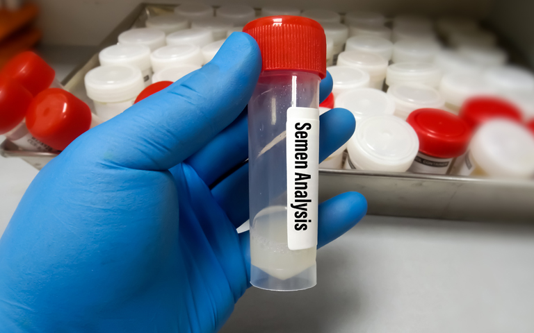 best IVF center in Junagadh, ICSI treatment in Junagadh, male fertility, semen analysis, male infertility treatment, low sperm count, poor sperm motility, abnormal sperm morphology, hormone imbalance in men, testosterone therapy, erectile dysfunction, ejaculation problems, fertility issues in men, male reproductive health, Dr. Pravin Dudhat, fertility specialist in Junagadh, testicular biopsy, sperm retrieval techniques, semen quality, vas deferens blockage, male fertility diagnosis, male hormone therapy, lifestyle and fertility, emotional support fertility, scrotal ultrasound, advanced fertility support, Unique IVF Centre Junagadh, male fertility evaluation