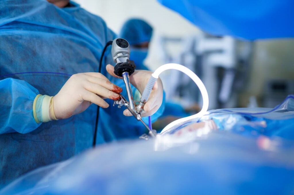 laparoscopic surgery, gynecological surgery, minimally invasive surgery, laparoscopic treatment, fertility treatment, IVF hospital, laparoscopic gynecology, uterine fibroids treatment, endometriosis surgery, ovarian cyst removal, ectopic pregnancy treatment, pelvic inflammatory disease, keyhole surgery, advanced laparoscopic techniques, best gynecologist, laparoscopic surgeon, fertility care, women’s health care, reproductive health, gynecological procedures, Unique Hospital, best IVF hospital