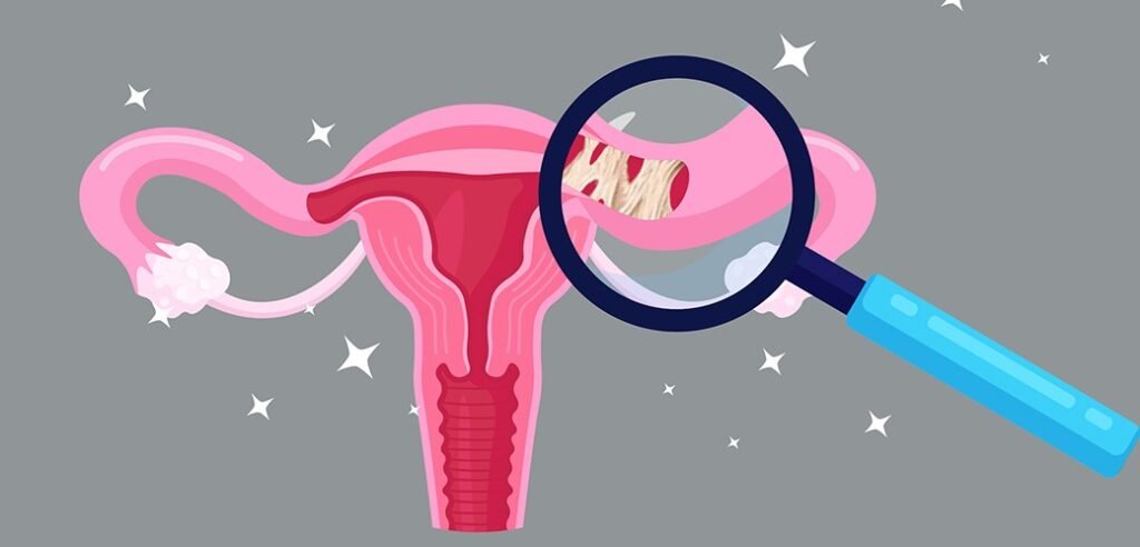 blocked fallopian tubes, fibroids and infertility, best IVF center in Junagadh, Unique IVF Junagadh, fertility center in Junagadh, ICSI treatment Junagadh, infertility treatment Junagadh, causes of female infertility, fallopian tube blockage treatment, fibroid treatment Junagadh, IVF for blocked tubes, laparoscopy for fertility, endometriosis and infertility, hysteroscopy Junagadh, reproductive health Junagadh, gynecological care Junagadh