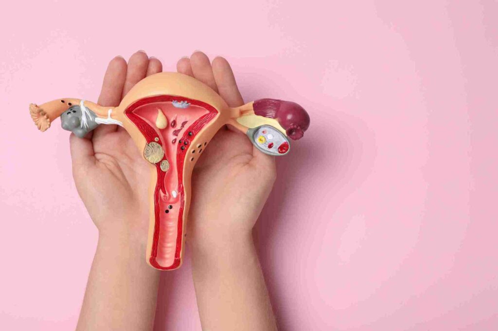 chocolate cyst treatment in Junagadh, endometrioma symptoms, chocolate cyst and infertility, best IVF center in Junagadh, Unique IVF Hospital Junagadh, ICSI treatment Junagadh, ovarian cyst diagnosis, laparoscopy for chocolate cyst, gynecologist in Junagadh, chocolate cyst fertility issues, chocolate cyst vs normal cyst, reproductive health Junagadh, endometriosis-related cysts, hormonal treatment for chocolate cyst