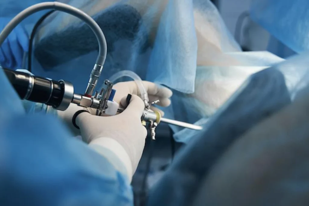 laparoscopy surgery in Junagadh, advanced laparoscopy surgery, fertility centre in Junagadh, best IVF center in Junagadh, Unique IVF Hospital Junagadh, Dr. Pravin M. Dudhat, gynecological laparoscopy, painless laparoscopy surgery, ICSI treatment in Junagadh, minimally invasive surgery Junagadh, laparoscopic fertility treatment, endometriosis laparoscopy Junagadh, ovarian cyst treatment Junagadh, female infertility surgery Junagadh, reproductive surgery in Junagadh, IVF and laparoscopy center Junagadh