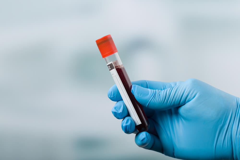 blood count during pregnancy, how to increase blood count naturally, iron-rich foods in pregnancy, best IVF center in Junagadh, pregnancy care tips Junagadh, ICSI treatment in Junagadh, folic acid benefits pregnancy, anemia during pregnancy, fertility hospital Junagadh, maternal health Junagadh