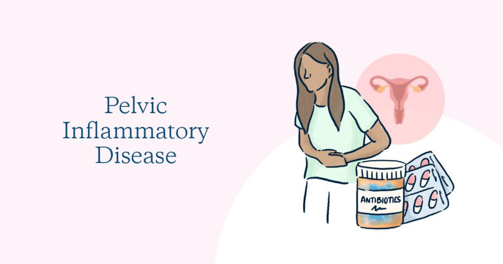 Pelvic Inflammatory Disease Junagadh, PID symptoms in women, fertility center in Junagadh, PID and infertility, best IVF center in Junagadh, ICSI treatment in Junagadh, PID causes and treatment, reproductive health Junagadh, gynecology care Junagadh, Unique IVF Hospital