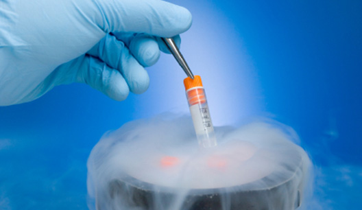 Fertility Centre in Junagadh, best IVF center in Junagadh, sperm freezing in Junagadh, egg freezing in Junagadh, fertility preservation in Junagadh, ICSI treatment in Junagadh, IVF treatment in Junagadh, embryo freezing in Junagadh, reproductive health in Junagadh, delayed childbearing fertility solutions Junagadh, chemotherapy fertility preservation Junagadh, genetic condition fertility preservation Junagadh, infertility treatment in Junagadh, advanced fertility treatments Junagadh, vitrification egg freezing Junagadh, semen freezing Junagadh, Unique IVF Hospital Junagadh, fertility specialists in Junagadh, embryologists in Junagadh, parenthood planning Junagadh