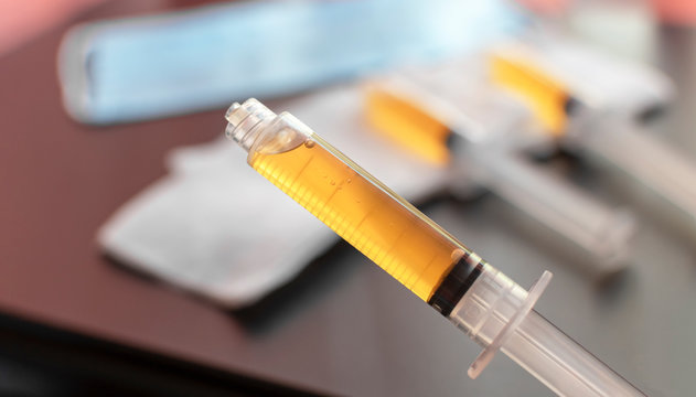 PRP injection Junagadh, women’s health Junagadh, vaginal rejuvenation Junagadh, PRP therapy for women Junagadh, PRP treatment Junagadh, Unique IVF Hospital, fertility centre in Junagadh, best IVF center Junagadh, ICSI treatment Junagadh, non-surgical women’s health treatment