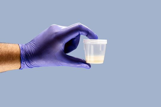 IVF treatment in Junagadh, IVF step by step guide, IVF process explained, IVF for couples in Junagadh, Unique IVF Center Junagadh, Dr Pravin M Dudhat IVF specialist, infertility treatment Junagadh, IVF success tips, IVF consultation Junagadh, fertility treatment Gujarat, IVF procedure India, IVF for blocked tubes, IVF for low sperm count, PCOS infertility treatment, endometriosis infertility treatment, ICSI treatment Junagadh, embryo transfer process, egg retrieval procedure, semen analysis IVF, IVF pregnancy test, IVF specialist Junagadh, best IVF center in Junagadh, IVF journey India, IVF lab fertilization, IVF embryo development, IVF luteal support, IVF success rate factors