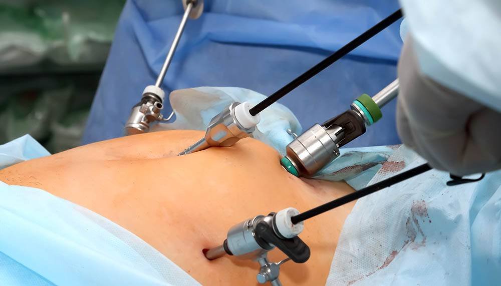 fibroid treatment in Junagadh, laparoscopic fibroid removal Junagadh, fibroid surgery Junagadh, Unique IVF Hospital fibroid treatment, uterine fibroids treatment Junagadh, laparoscopy for fibroids, best fertility centre in Junagadh, fibroid symptoms and treatment, fibroids and infertility, ICSI treatment in Junagadh, IVF centre Junagadh, minimally invasive fibroid surgery, advanced laparoscopy Junagadh, gynecologist in Junagadh, female fertility treatment Junagadh, uterine fibroid specialist Junagadh, fertility evaluation Junagadh, women’s health care Junagadh, best gynecologist for fibroids, IVF and laparoscopy combined treatment