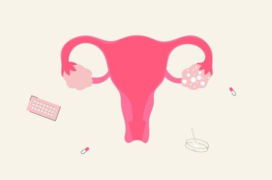 PCOS explained, Polycystic Ovary Syndrome, PCOS symptoms, PCOS diagnosis, PCOS treatment options, PCOS and infertility, PCOS hormonal disorder, irregular periods PCOS, PCOS weight gain, PCOS acne and hair growth, insulin resistance PCOS, fertility issues with PCOS, PCOS ovulation problems, Fertility Centre in Junagadh, best IVF center in Junagadh, PCOS fertility treatment, IVF for PCOS, ICSI treatment in Junagadh, assisted reproductive technology PCOS, PCOS lifestyle management, PCOS medication treatment, PCOS